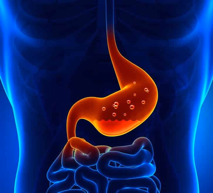 Hvad gør man ved mavesyre i spiserøret?